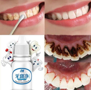 10ML TEETH WHITENING WATER