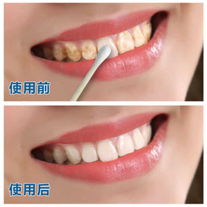 10ML TEETH WHITENING WATER