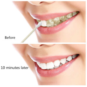 10ML TEETH WHITENING WATER