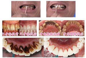 10ML TEETH WHITENING WATER