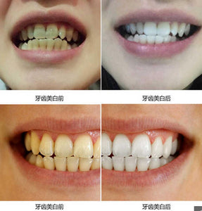 10ML TEETH WHITENING WATER